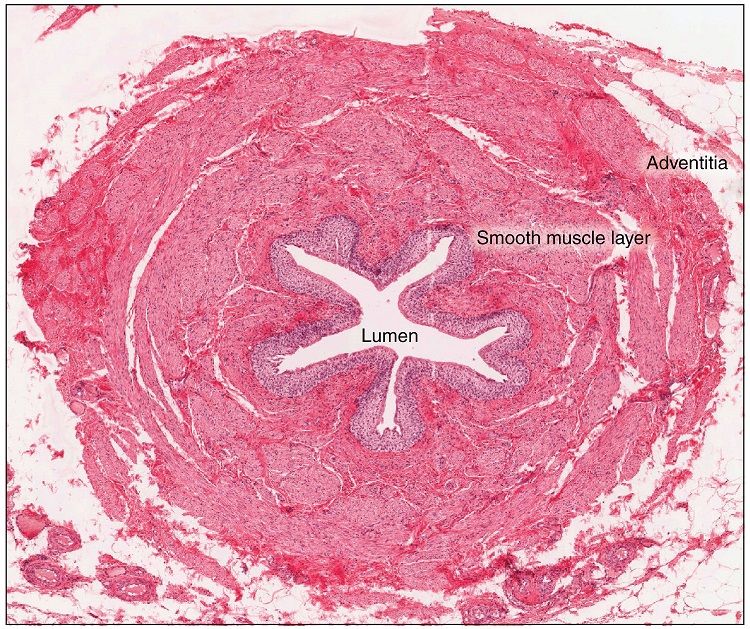 Cross-section histology photo of ureter with major regions labeled.