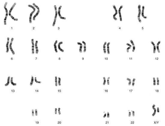22 pairs and Male chromosomes