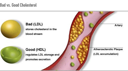 Illustration, with labels, showing bad versus good cholesterol