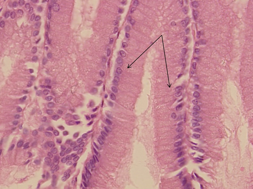 epithelium rahisi ya columnar kama inavyotazamwa chini