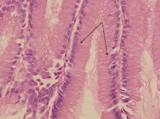 simple columnar epithelium as viewed under the microscope