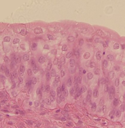 transitional epithelium as viewed under the microscope