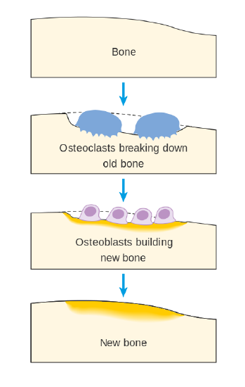 Diagram showing bone remodeling where osteolcasts break down old bone and then osteolblasts come in to build new bone.
