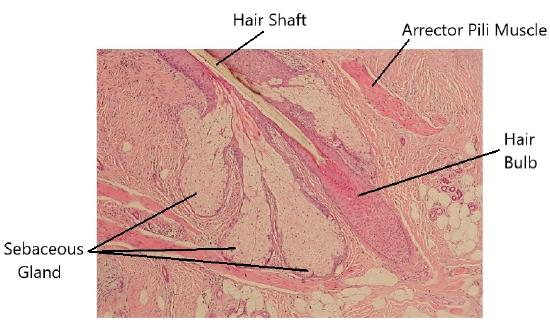 Microscope view of hair follicle