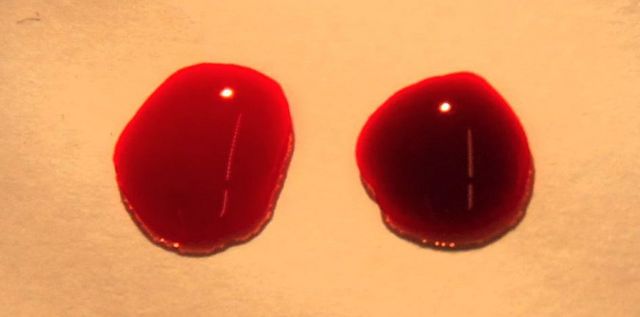 Two drops of blood are shown side-by-side: a bright red drop of oxygenated blood on the left and a darker red drop of deoxygenated blood on the right.