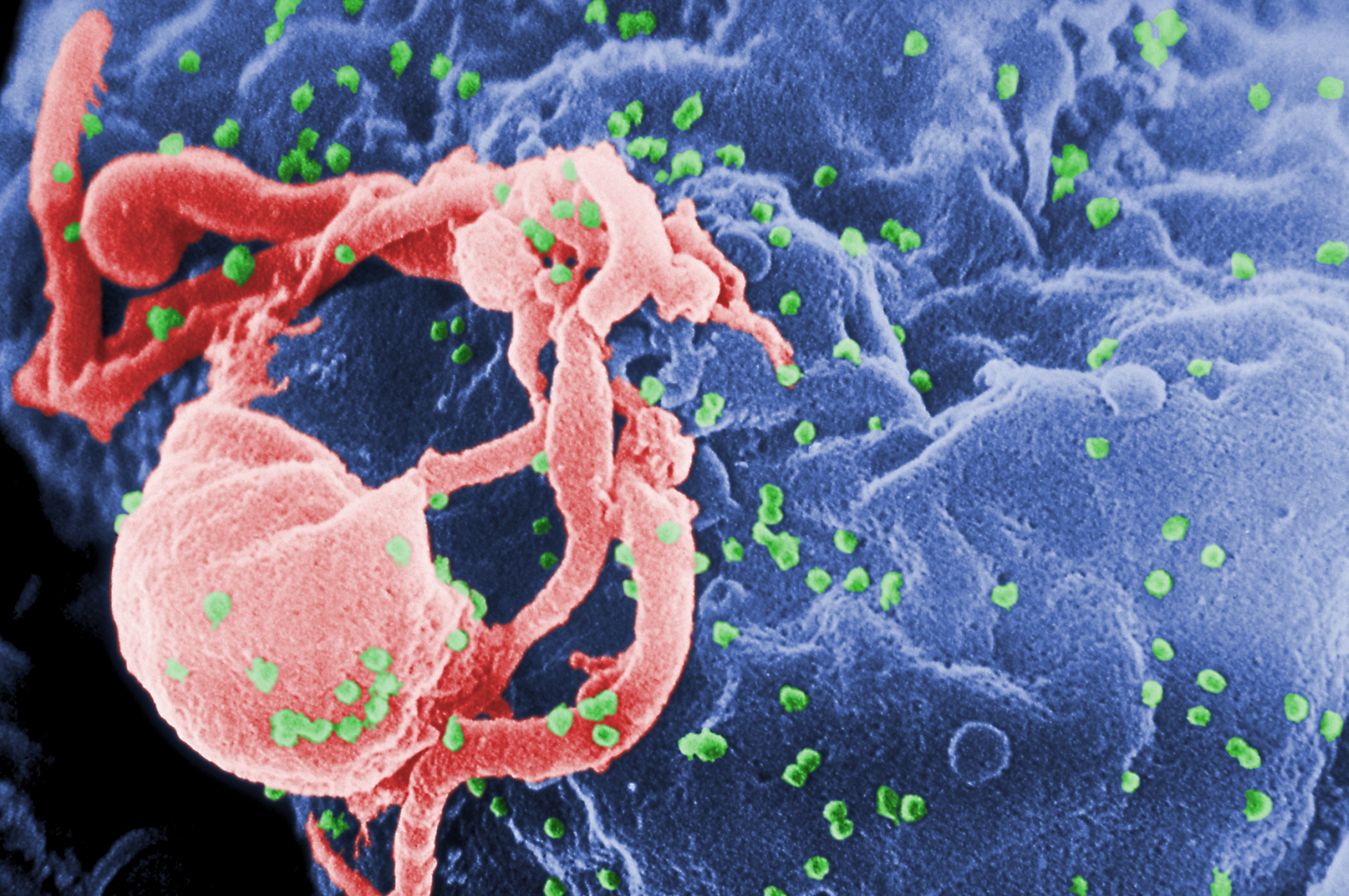 Scanning electron micrograph of HIV virions budding from a white blood cell.