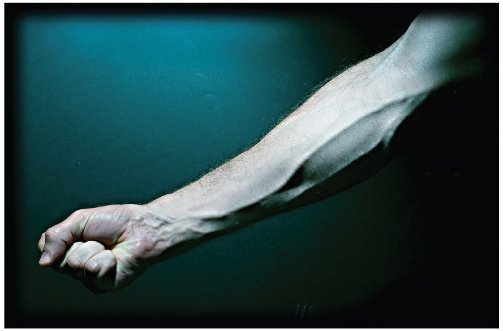 Photograph of lower limb and fist with superficial veins visible under the skin.