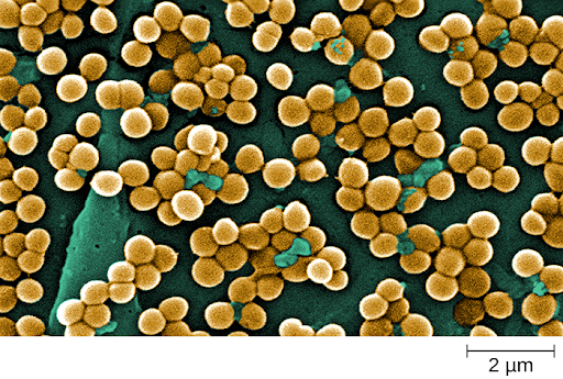 Staphylococcus-aureus.png