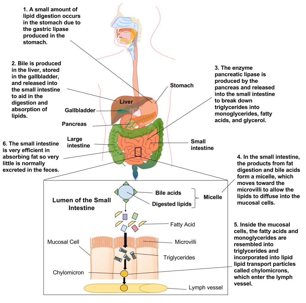 Illustrated diagram of human body showing lipid digestion and absorption. 1. Small amount of lipid digestion occurs in stomach due to gastric lipase produced in stomach 2. Bile produced in liver, stored in gallbladder, release into small intestine to aid digestion and absorption of lipids. 3. Pancreatic lipase produced by pancreas and released into small intestine to break down triglycerides, fatty acids, and glycerol. 4. In small intestine products from fat digestion and bile acids form micelle, which moves towrad the microvilli allowing lipids to diffuse into mucosal cells. 5. Inside mucuosal cell, fatty acids and monoglycerides reassembled into triglycerides and incorporated into lipids transport particles called chylomicrons, which enter the lymph vessel.