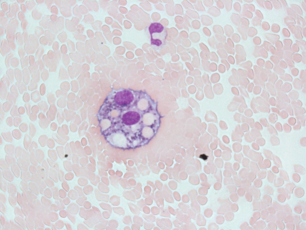 0410Erythrophagocytosis3-Gloria-Kwon-1024x771.jpg