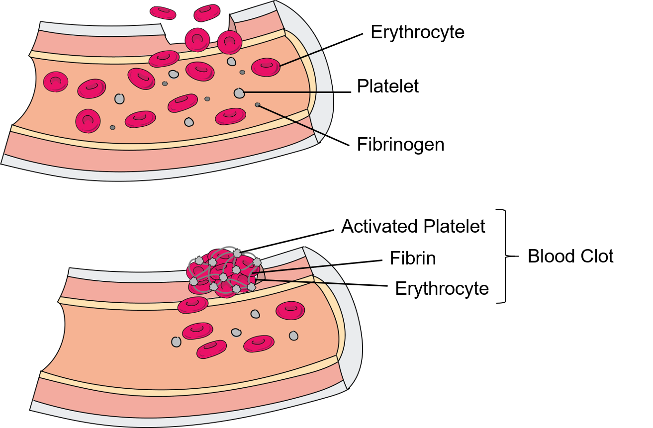 Blood clots form when activated platelets and fibrin stick to erythrocytes.