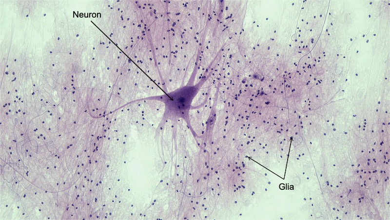Neuroni ya multipolar iliyozungukwa na dots ndogo, ambazo ni seli za glial.