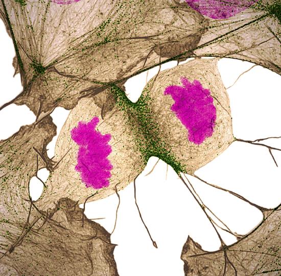 Microscopic image of human fibroblast cells undergoing division