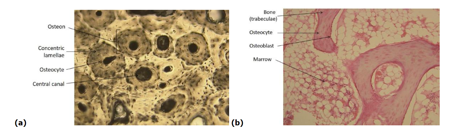 compact and cancellous bone tissue as viewed under the microscope
