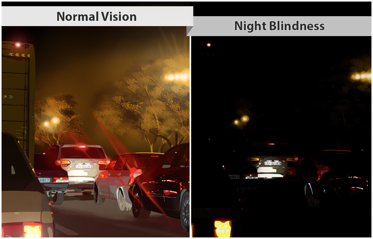 Two photos compare normal vision and night blindness. At left, normal night vision is shown in a photo of traffic at night, with light clearly visible from the car light and street lights. At right, night blindness is shown, with only dim lights from cars and street lights.