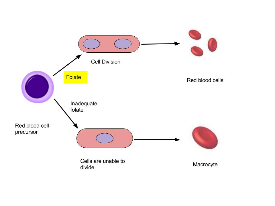 Image shows two pathways for a red blood cell precursor: the first pathway shows how folate helps the cell divide appropriately into red blood cells and the second pathway shows how without adequate folate intake, cells are unable to divide and they become oversized and incomplete, resulting in macrocytic anemia.