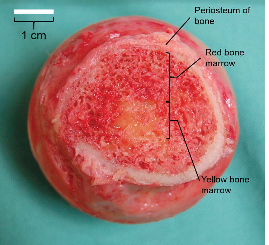 Bone marrow in the head of the humerus. Visible around the trabeculae of spongy bone is red bone marrow around the outer 70% of the section, with an area of yellow bone marrow at the center 30% of the section.