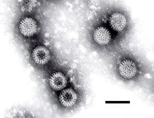Rotavirus.jpg