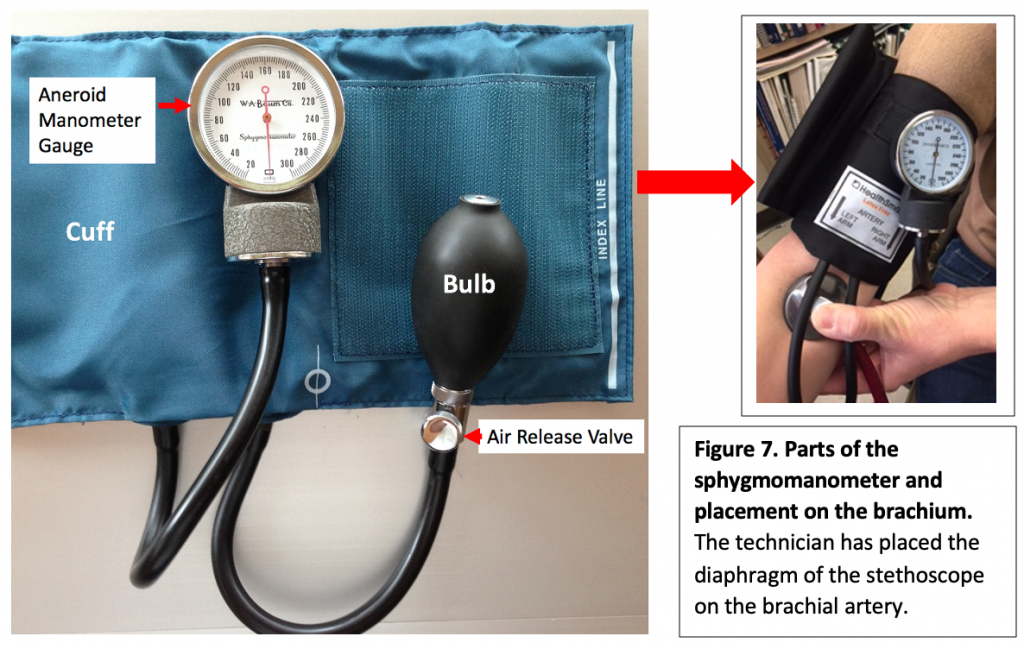 Parts of the sphygmomanometer and its placement on the brachium.