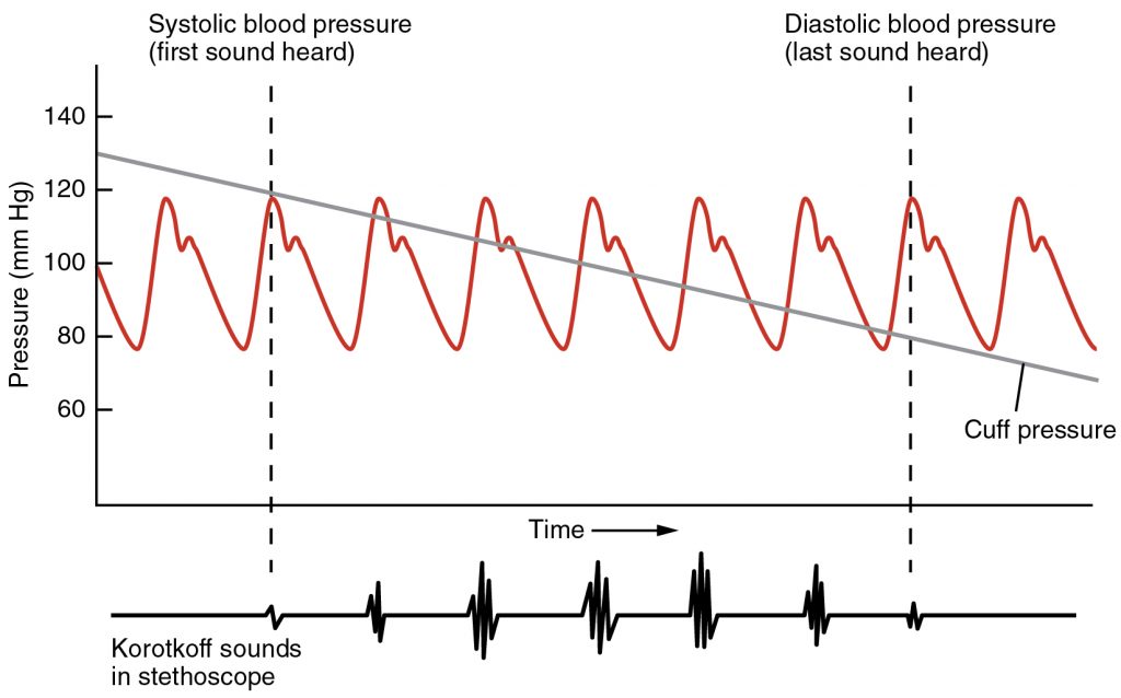 Figura 8. Medición de la presión arterial. Cuando se libera la presión del manguito, el clínico puede escuchar el primer sonido de Korotkoff cuando la sangre comienza a fluir nuevamente a través de la arteria braquial. Esta es la presión sistólica. Cuando se escucha el último sonido de flujo de soplado turbulento, la presión se registra como diastólica.