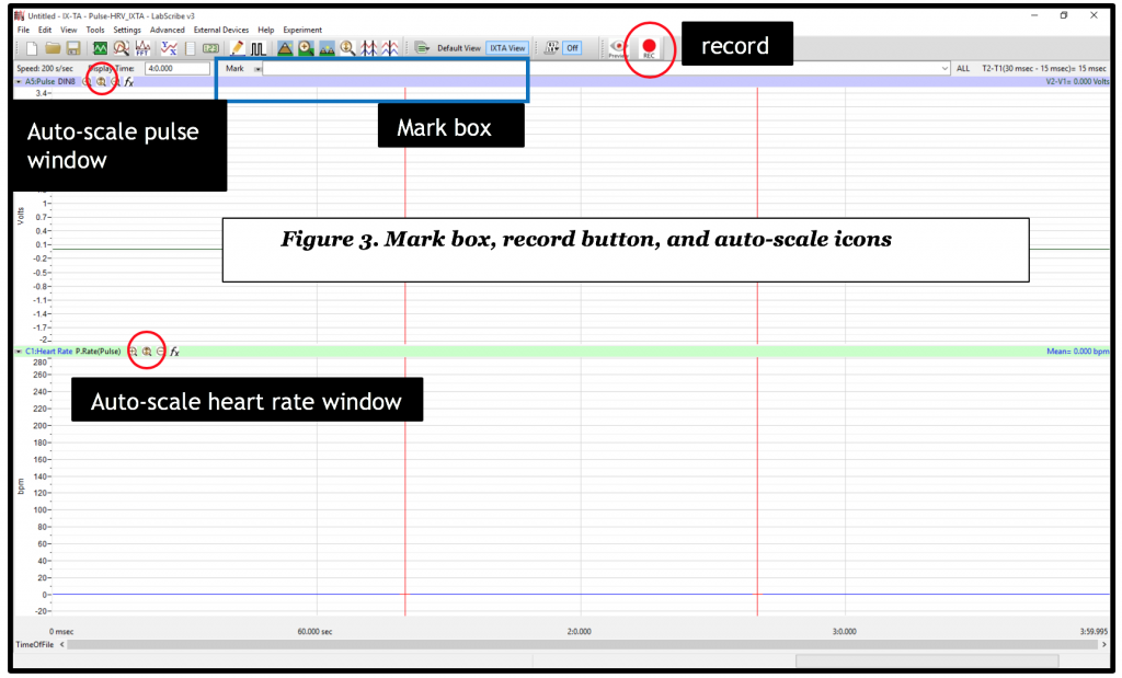 LabScribe labeled with record, auto-scale, and mark box