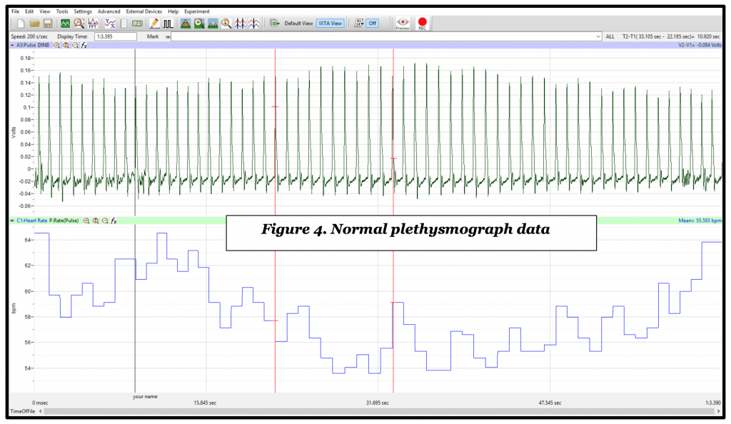 Plethysmograph data in LabScribe
