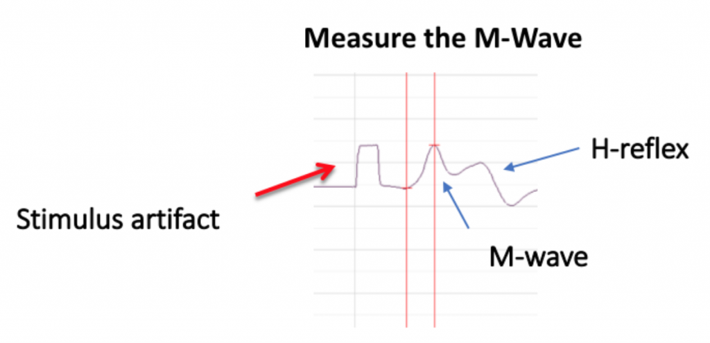 A stimulus artifact, M-wave, and H-wave are labeled.