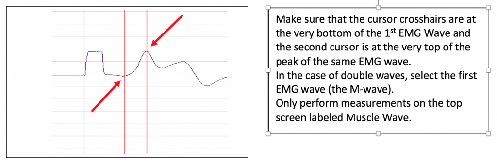 Make sure the cursor crosshairs are at the very bottom of the 1st EMG Wave and the second cursor is at the very top of the peak of the same EMG wave.