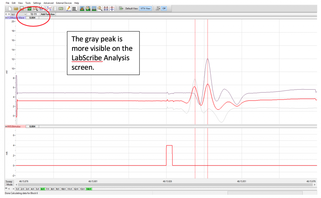 The gray peak is more visible on the LabScribe Analysis screen.