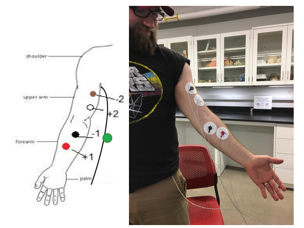 electrodes labeled on the arm