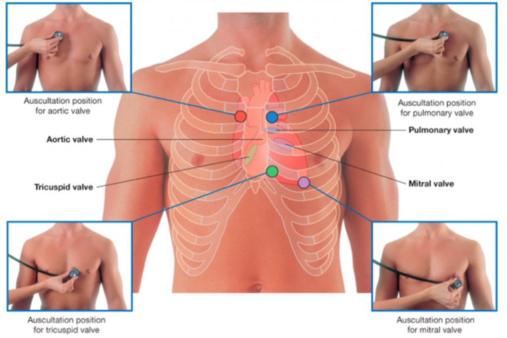 auscultation positions of valves of the heart labeled