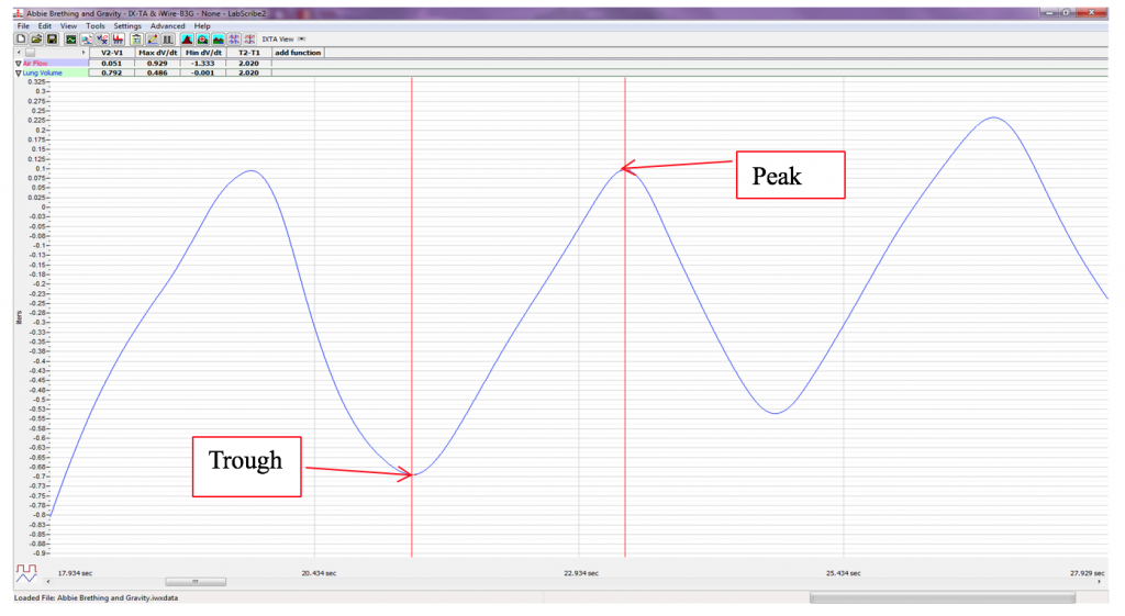 Peak (tip of wave) and trough (low point of wave) are labeled on a breathing pattern