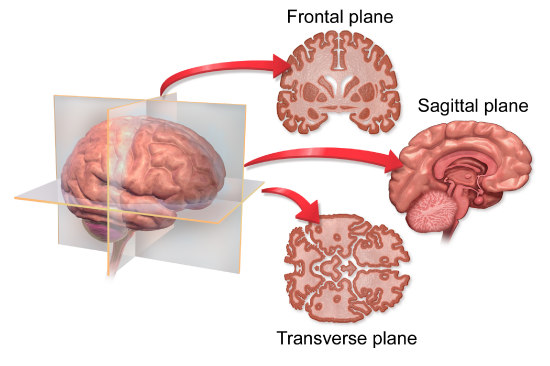 Sectional planes of view of a human brain