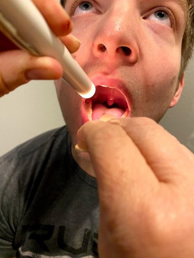 Foto que muestra a un paciente simulado con la boca y la garganta