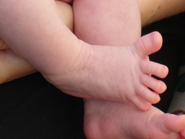 Foto que muestra primer plano de los dedos extendidos de un bebé