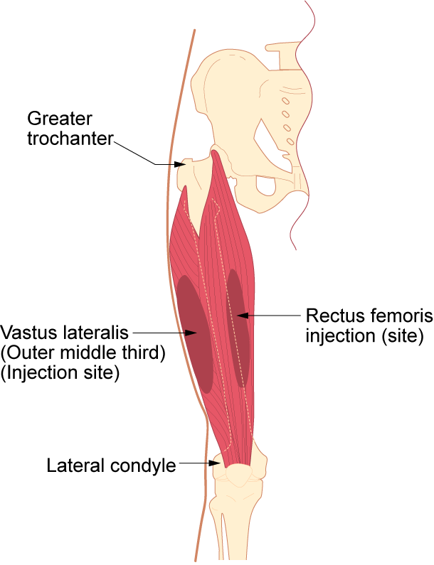Illustration showing vastus lateralis site, with labels