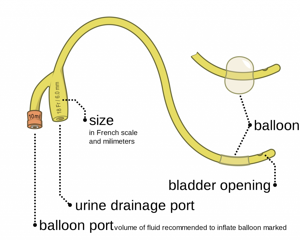 Illustration showing Parts of an Indwelling Catheter, with labels