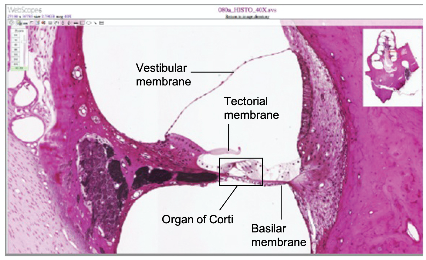 Micrograph of a cochlear cross section with vestibular, tectorial and basilar membranes, and organ of Corti.