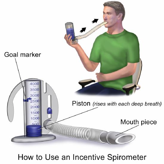 Image showing a person Using an Incentive Spirometer
