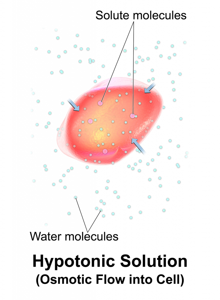 Image showing Hypotonic IV Solution Causing Osmotic Movement of Fluid Into Cell