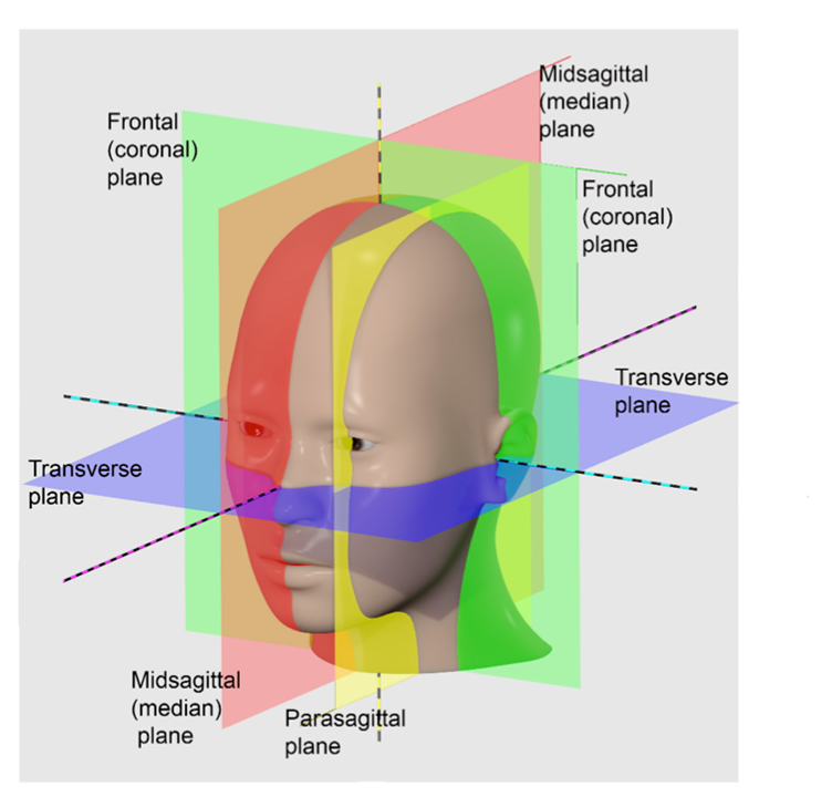 Computer generated image of a person's head, showing the transverse cut as a sheet of paper going from the nose out the back of the head, the frontal (coronal) plane as a paper 