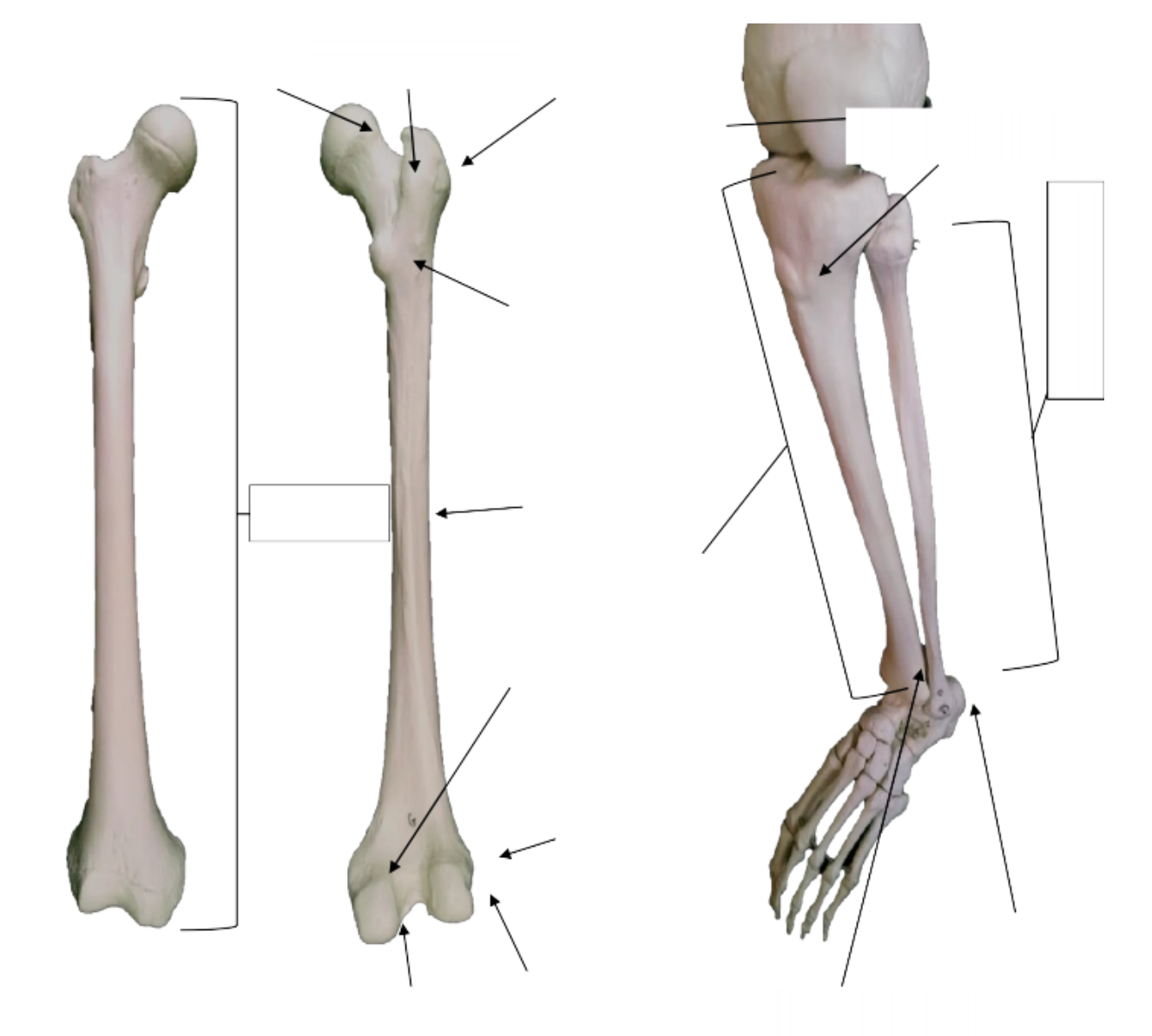 6.7: Bones of the Upper Limb - Medicine LibreTexts