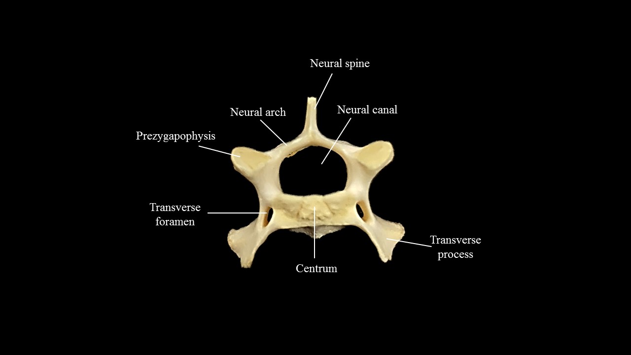 Thoracic vertebra of the cat