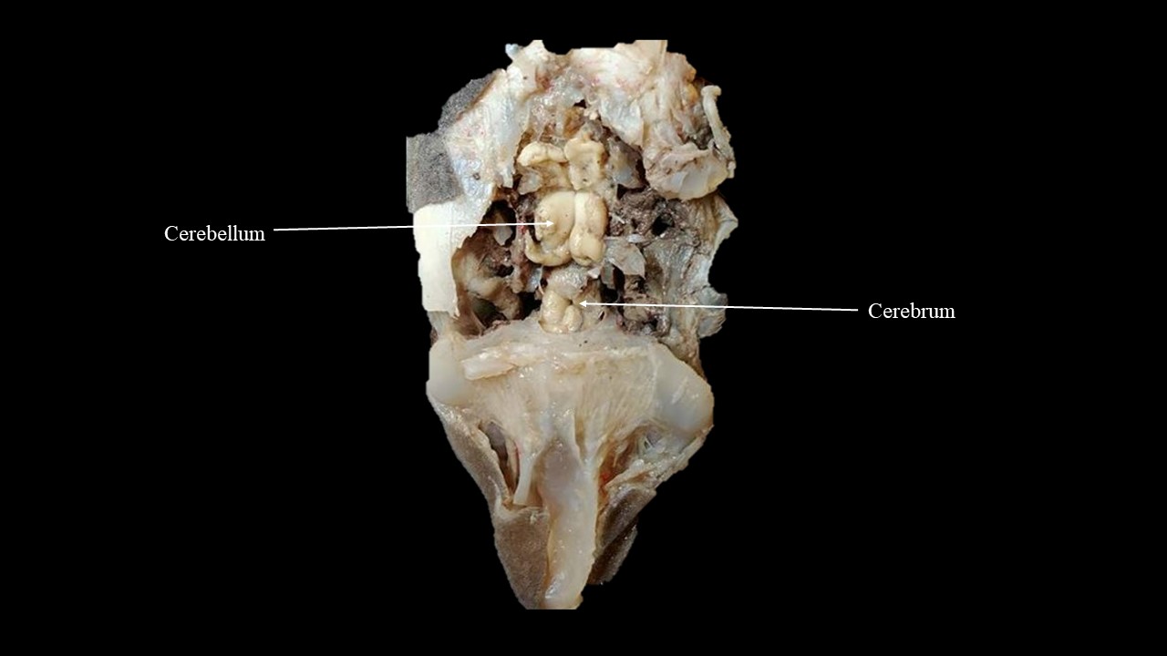 Vista dorsal del cerebro de tiburón