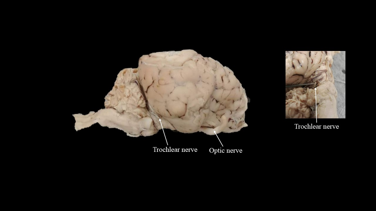 Vista lateral del cerebro de oveja.