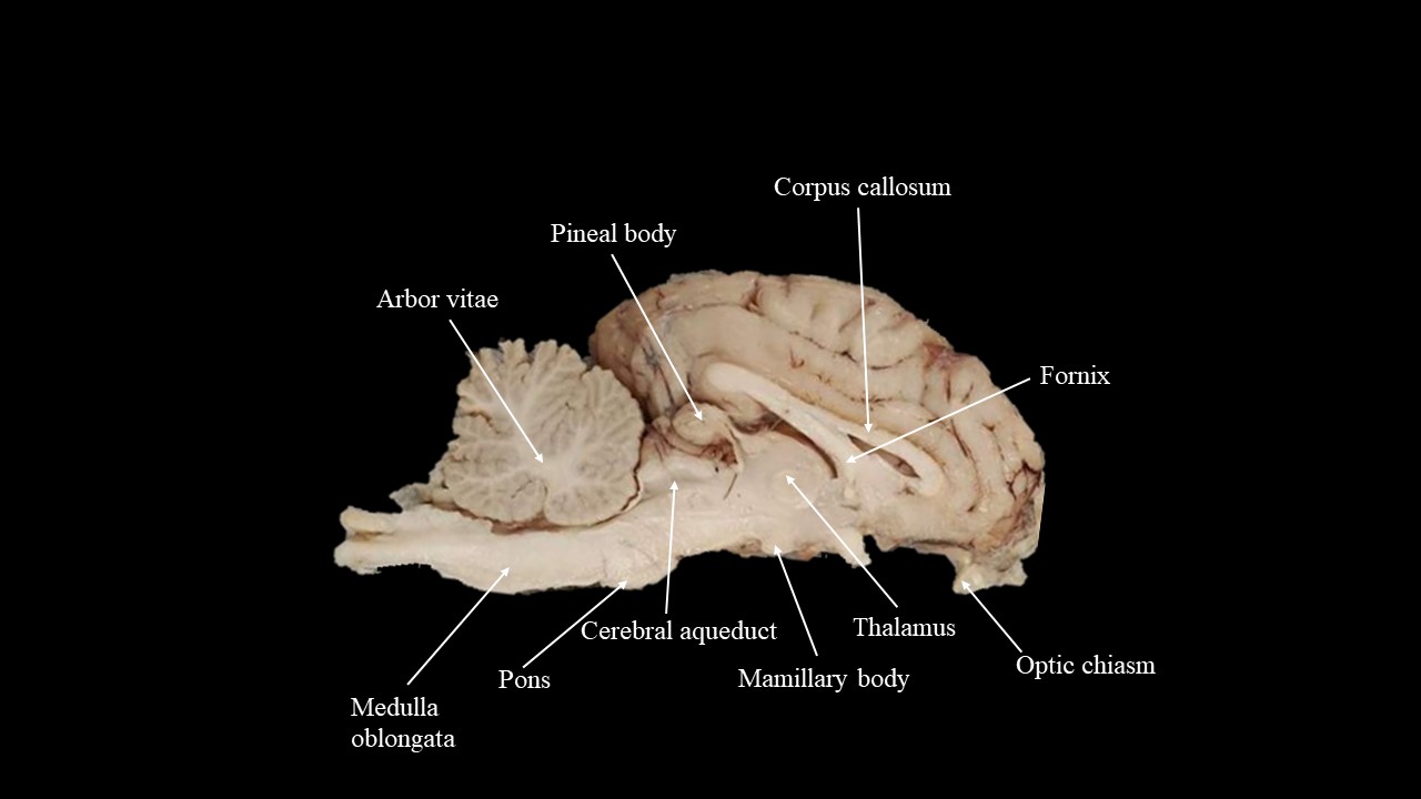 Vista sagital del cerebro de oveja.