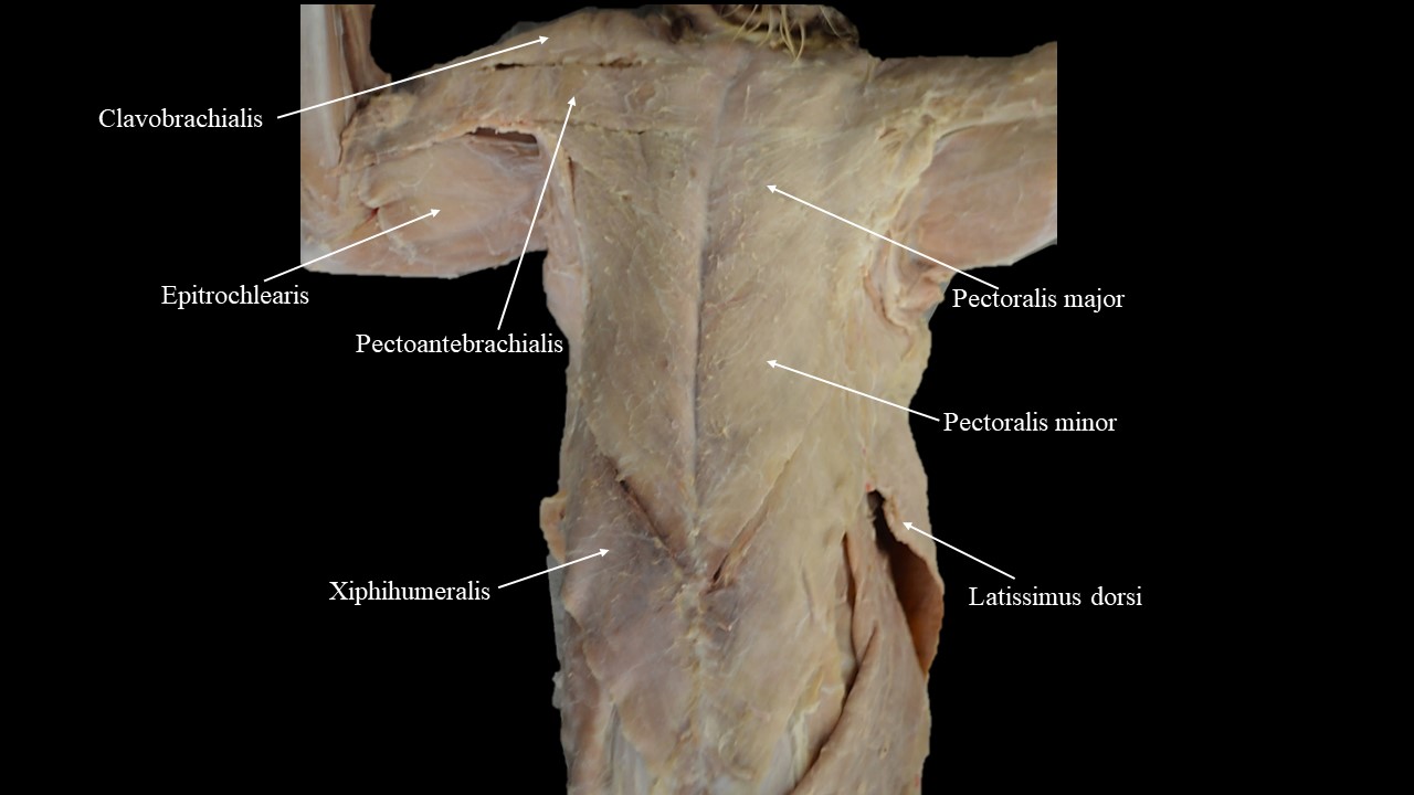 Vista ventral de los músculos del pecho del gato.