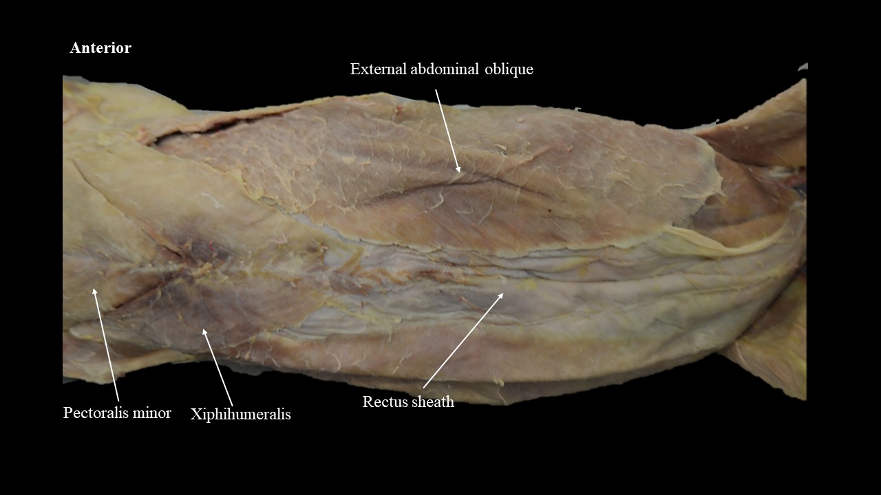 Vista ventral de los músculos externos abdominales del gato