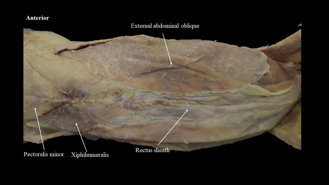 Ventral view of the cat abdominal external muscles