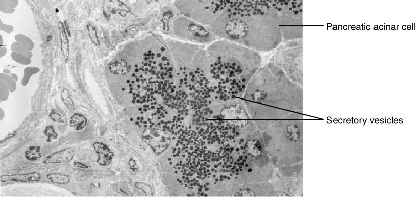 Micrograph ya seli za acinar za kongosho zilizojaa vidonda vya siri